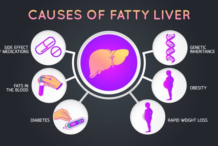 علت های کبد چرب