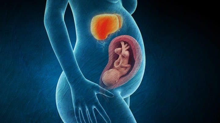 کبد چرب در زنان باردار