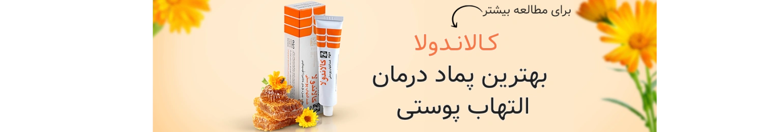 کالاندولا بهتریت پماد برای درمان التهاب پوستی