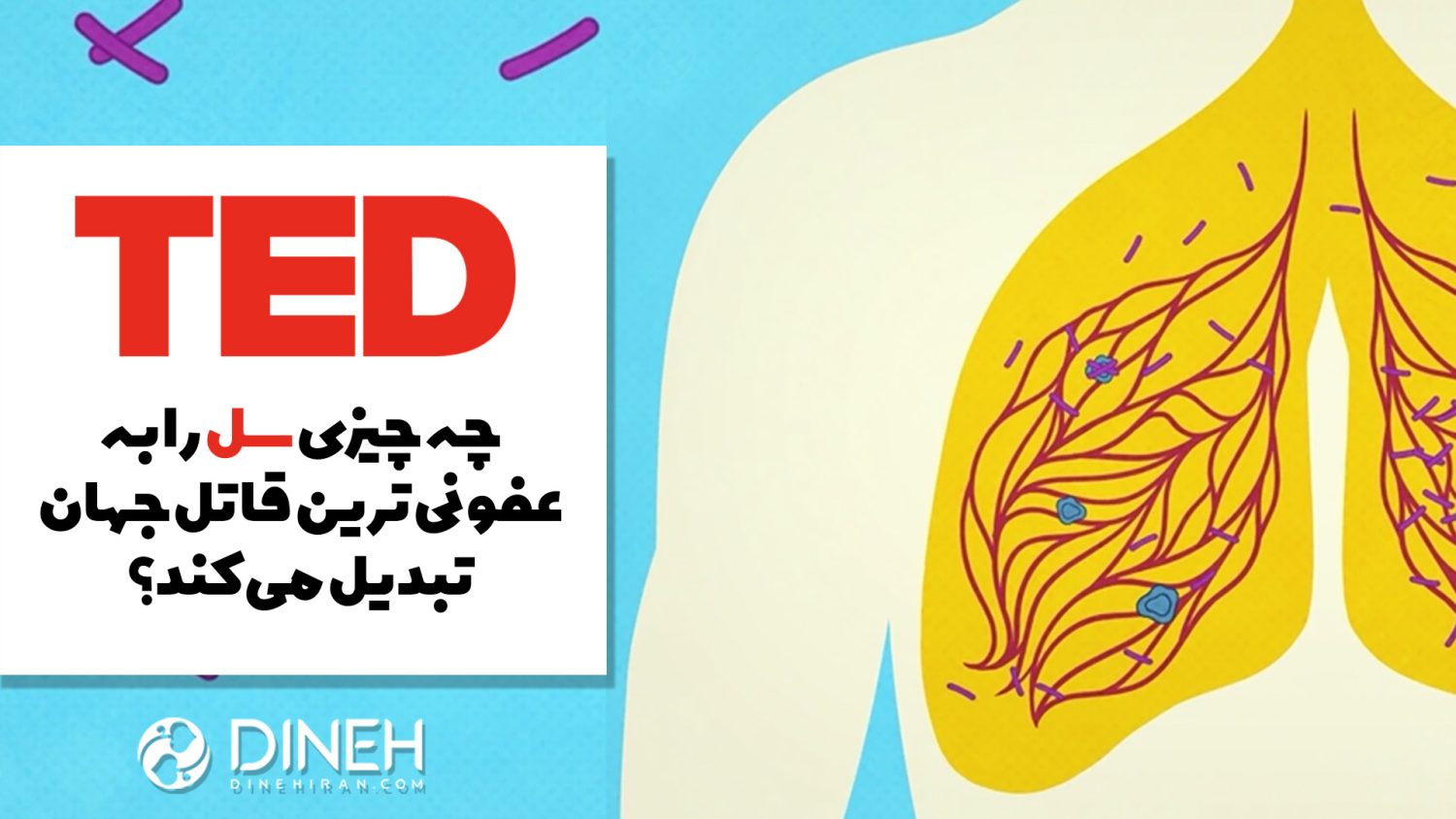 سل عفونی ترین قاتل جهان