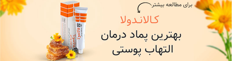 تفاوت پماد کالاندولا با پماد هیدروکورتیزون