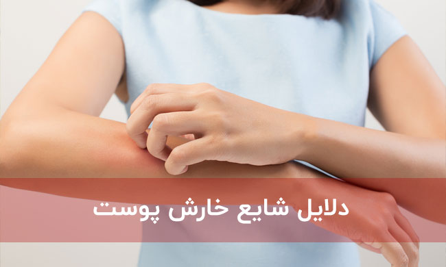 دلایل شایع خارش پوست / بهترین پماد برای خارش بدن