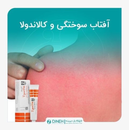 پماد کالاندولا