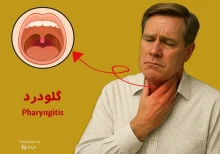 گلودرد یا فارنژیت شدید چیست و چطور درمان میشود؟