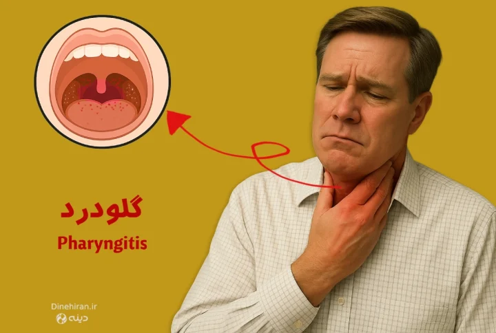گلودرد یا فارنژیت شدید چیست و چطور درمان میشود؟