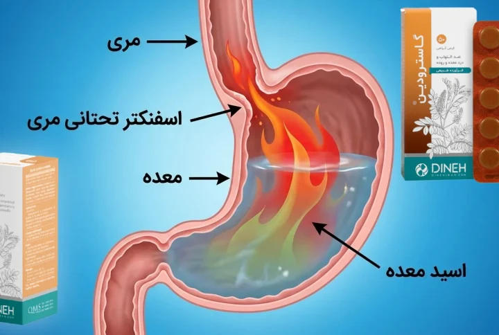 قرص رفلاکس معده