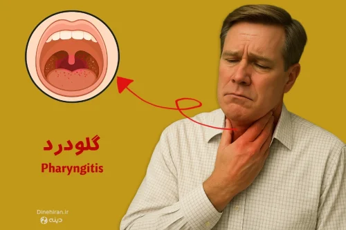 گلودرد یا فارنژیت شدید چیست و چطور درمان میشود؟