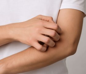 بهترین دارو برای خارش بدن چیست؟ راهنمای کامل درمان