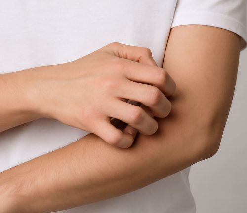 بهترین دارو برای خارش بدن چیست؟ راهنمای کامل درمان